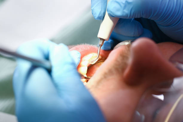 Best Walk-In Emergency Dentist in Olivette, MO